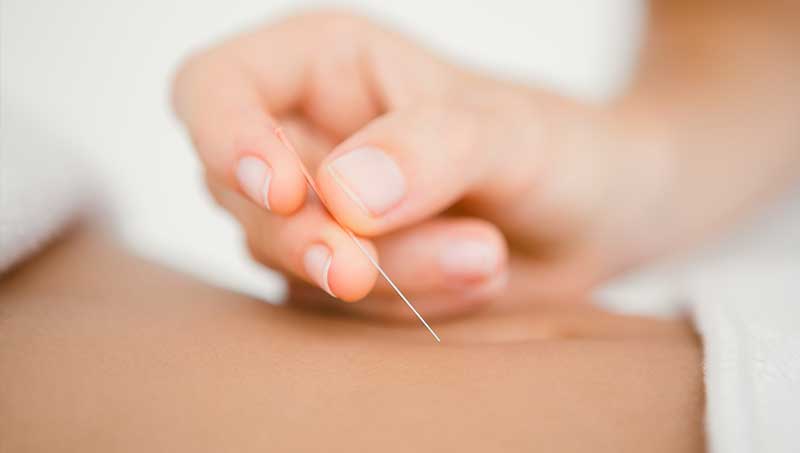 Acupuncture and Psycho-emotional Factors