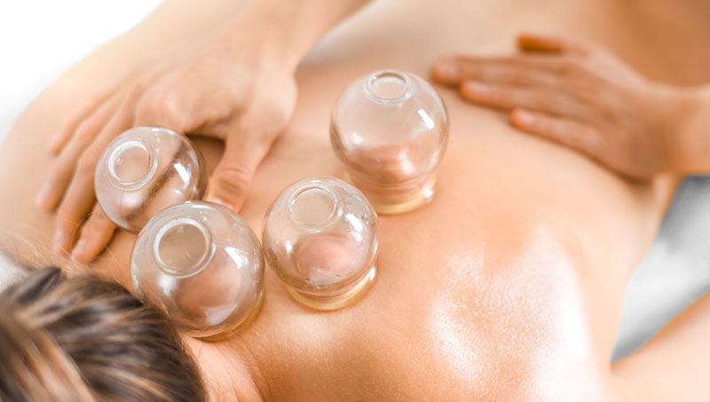 Cupping Therapy