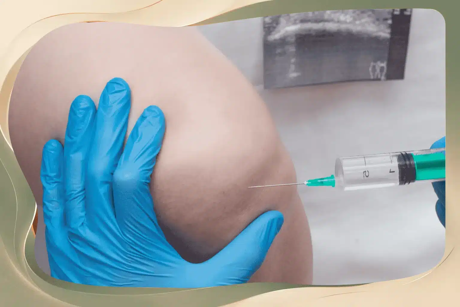 What Is the Success Rate of Joint Injections in Seniors